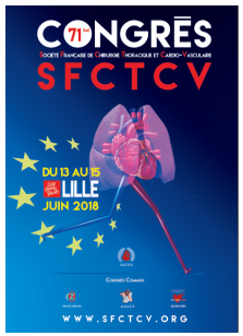 SFCTCV