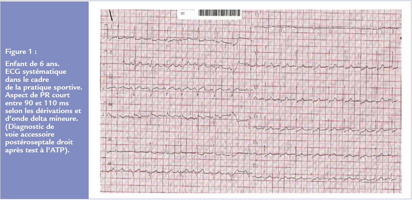 Figure 1 article 2