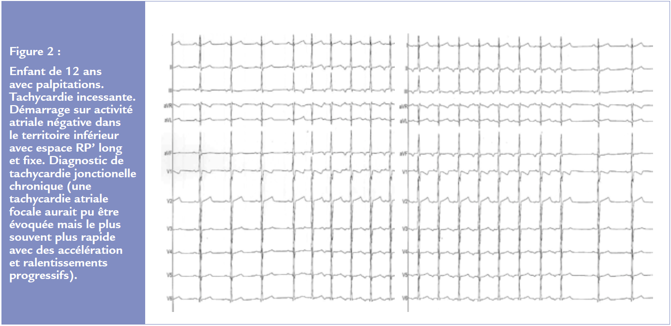 figure 2 article 2