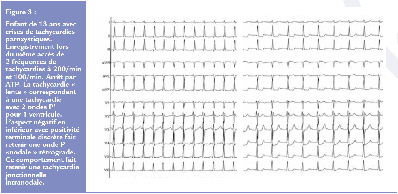 figure 3 article 2