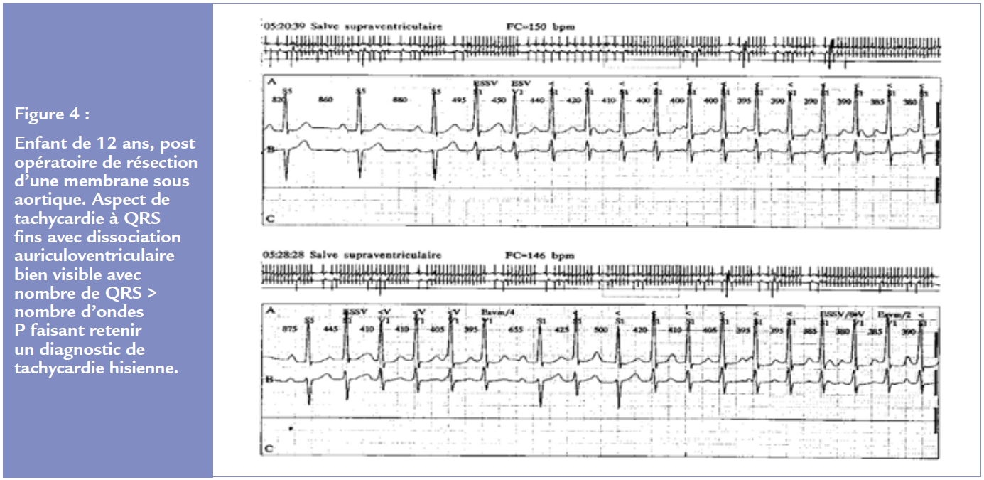 figure 4 article 2