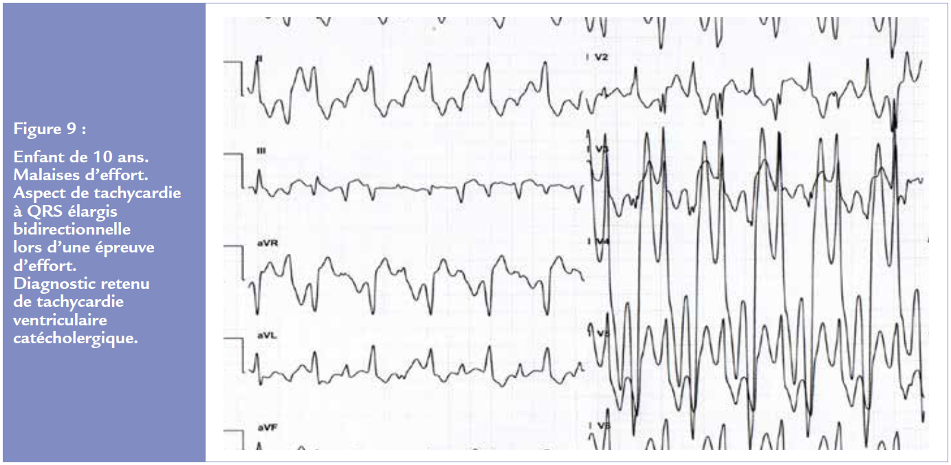 figure 9 article 2