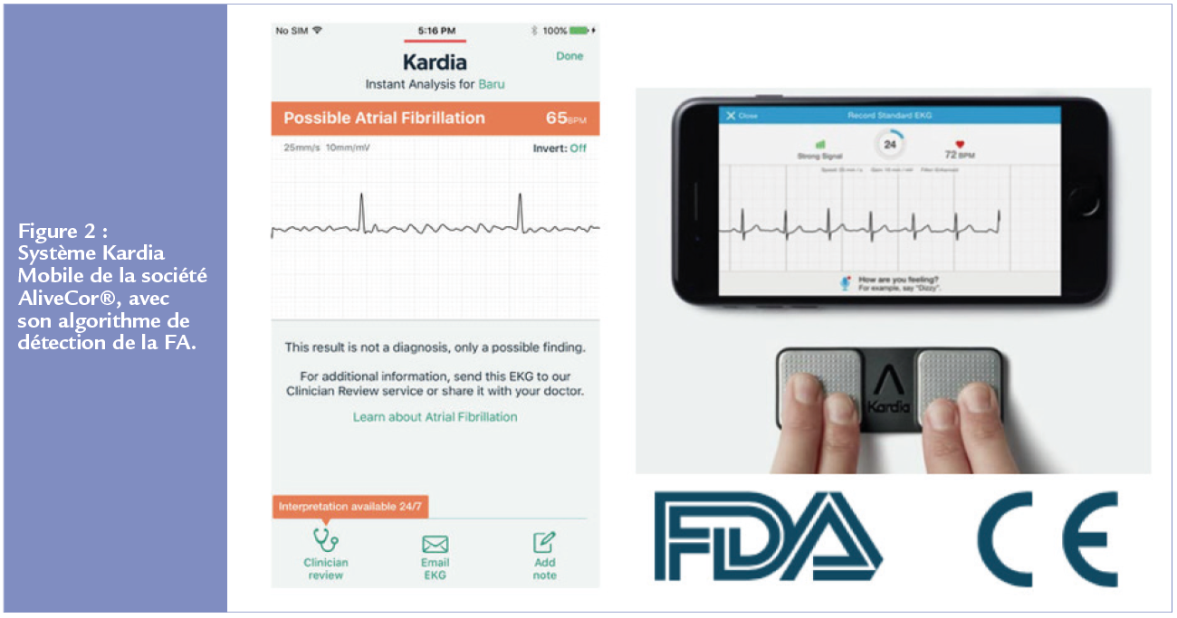 Fibrilation artiale - Figure 2