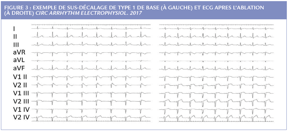 Figure 3 article 4